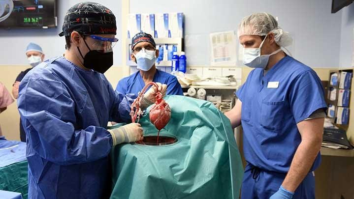 Catat Sejarah, Ini Manusia Pertama Terima Transplantasi Jantung dari Babi Catat Sejarah, Ini Manusia Pertama Terima Transplantasi Jantung dari Babi