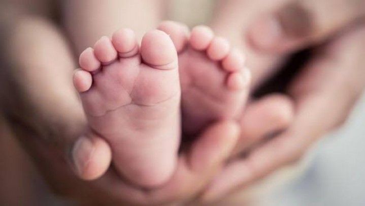 Bayi Kembar Siam di Palembang: Dua Kepala pada Satu Tubuh