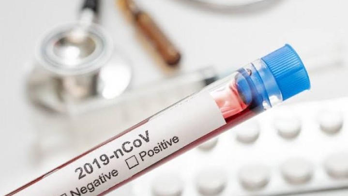 Covid-19 Riau: Bertambah 28 Pasien Sembuh Covid-19 Riau: Bertambah 28 Pasien Sembuh