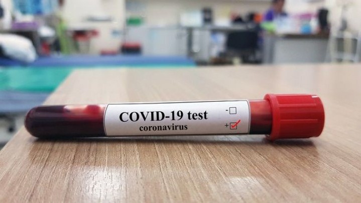 Di Riau, Bertambah 43 Pasien Sembuh dari Covid-19 Di Riau, Bertambah 43 Pasien Sembuh dari Covid-19