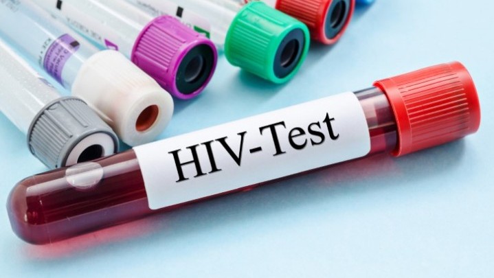 Di Riau, Pengidap HIV/AIDS Terbanyak ada di Pekanbaru Di Riau, Pengidap HIV/AIDS Terbanyak ada di Pekanbaru