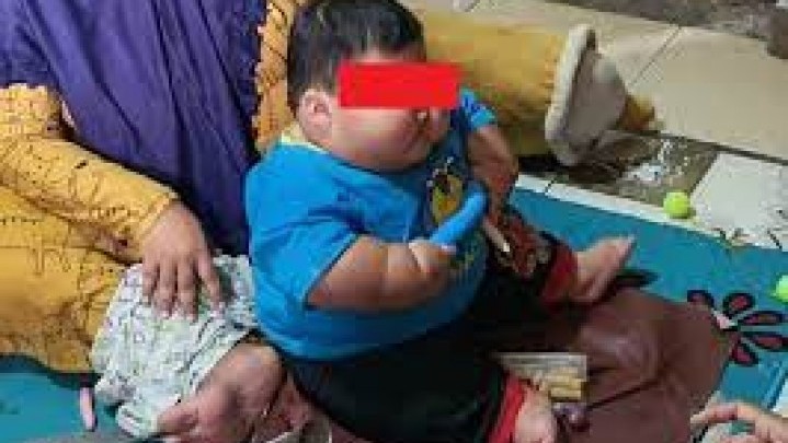 Bayi 16 Bulan di Bekasi Punya Berat 27 Kg Bayi 16 Bulan di Bekasi Punya Berat 27 Kg