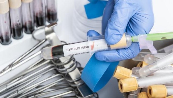 Di Kota Dumai Paling Banyak Ditemukan Kasus Sifilis